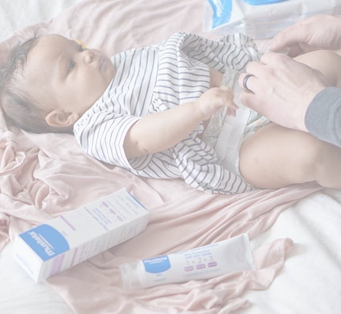 The 4 types of nappy rash and how to treat it | Guides
